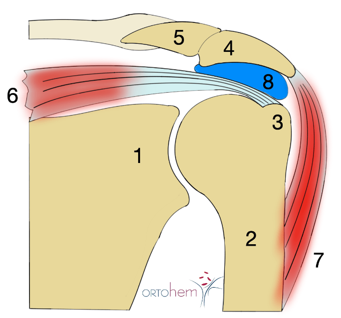 Ortopedska problematika ramena